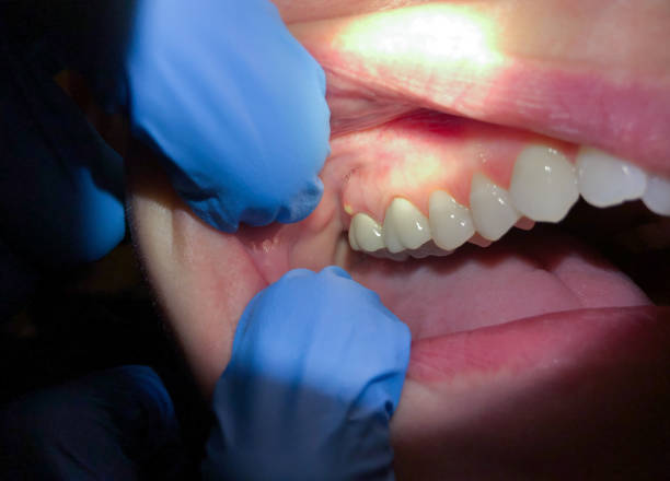 Best Emergency Treatment for Jaw Pain or Injury in South Portland, ME